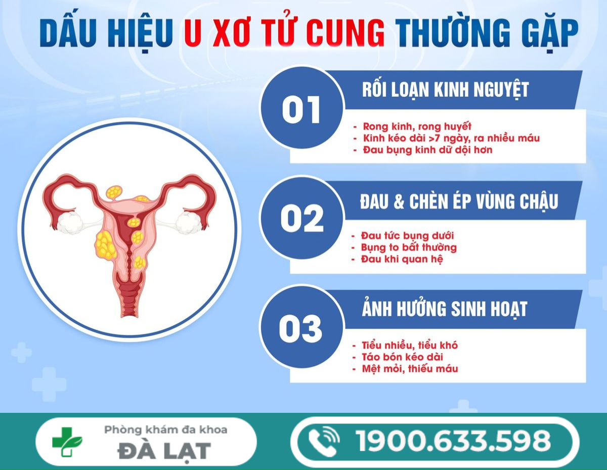 Hình ảnh minh họa